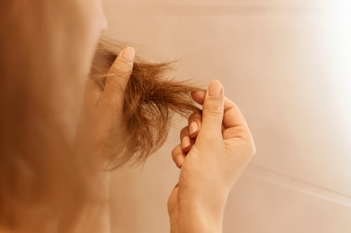 Rambut Sering Rontok? Harus Waspada, Bisa Jadi Efek dari Gejala Kolesterol, Begini Penjelasannya