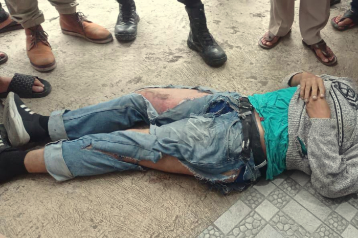 Buruh Pabrik Tewas Terlindas Truk Fuso di Sukabumi, Polisi: Korban Kurang Hati-hati