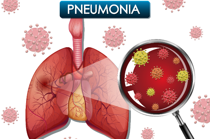 Atas Himbauan Wabah Pneumonia di China, Berikut Cara Mengetahui Gejala, Penyebaran serta Pencegahannya