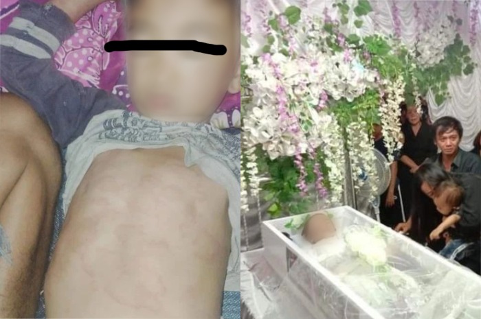 Geger! Seorang Bocah SD di Sulawesi Utara Tewas Usai Suntik Vaksin di Sekolah, Kok Bisa?