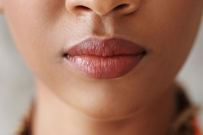 Perlu Dihindari! Berikut Sederet Kebiasaan yang Bikin Bibir Jadi Gelap 