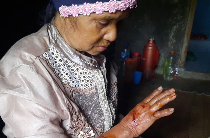 Atap Dapur Rumahnya Roboh, Nenek di Cihaur Sukabumi Luka-luka