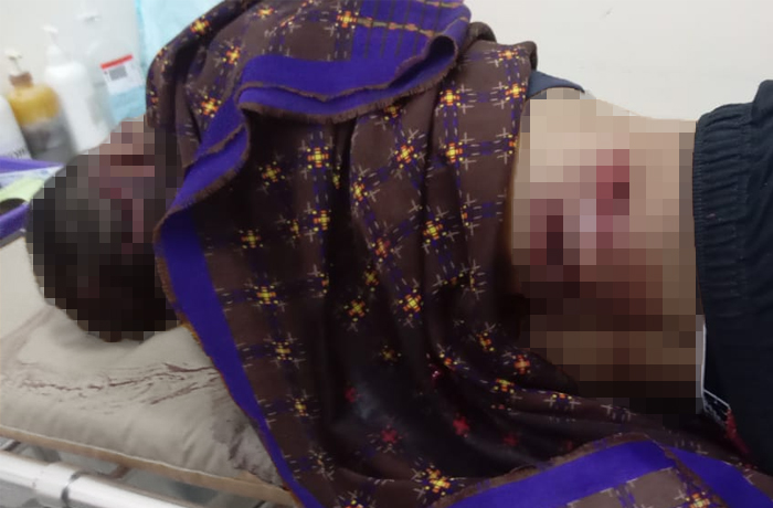 Pria di Ciambar Sukabumi Kritis Usai Dibacok oleh Mantan Kekasih Istrinya
