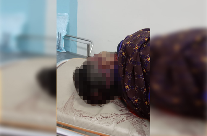 Pria di Ciambar Sukabumi Kritis Usai Dibacok Mantan Kekasih Istrinya, Begini Kesaksian Sang Istri